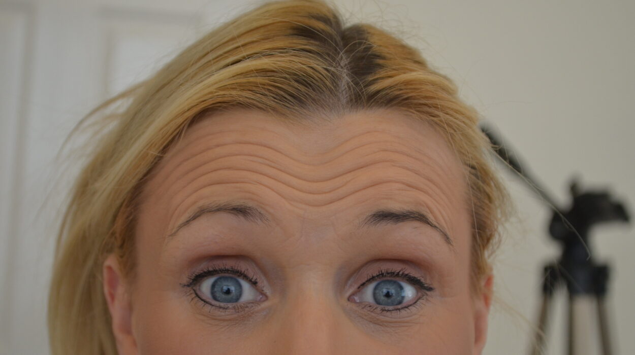Anti Wrinkle Injections Before