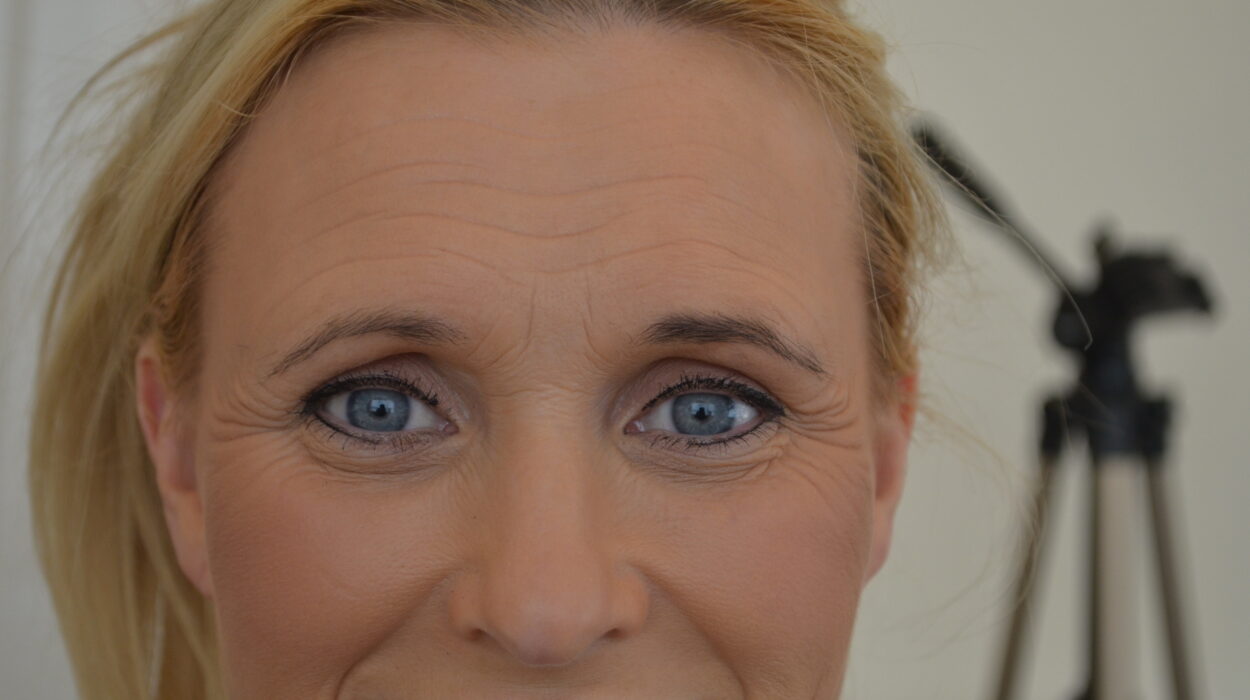 Anti Wrinkle Injections Before